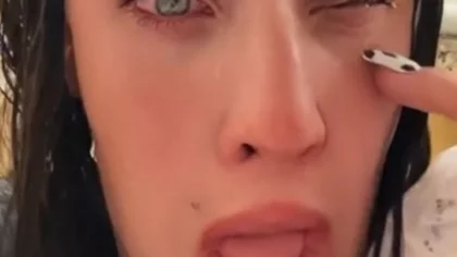 Casi pierde un ojo: usó pegamento pensando que eran gotas