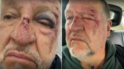 Se tropezó, pensaron que era un ladrón y lo desfiguraron