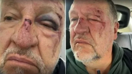 Se tropezó, pensaron que era un ladrón y lo desfiguraron