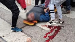Conducía a gran velocidad y chocó a un peatón: esta grave