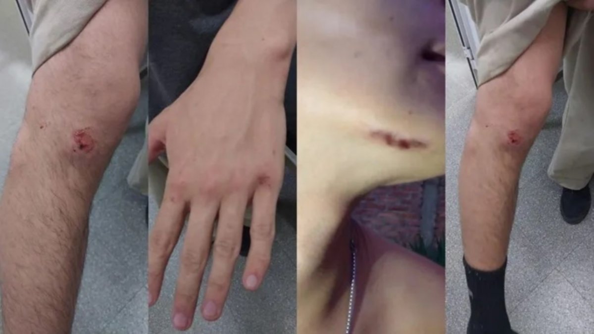 Golpiza a cinco jóvenes deja a la policía bajo la lupa