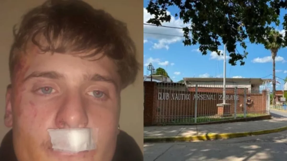 Brutal ataque de rugbiers dejó a un joven en grave estado
