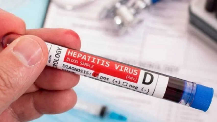 Preocupación por el aumento de casos de hepatitis C: cuáles son los síntomas