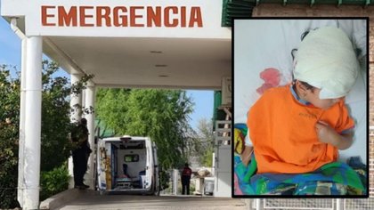 Fueron al mercado del barrio y un perro atacó a su hija de 4 años