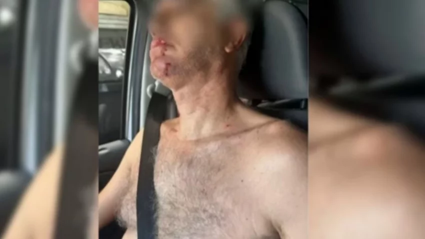 Un médico fue atacado por un grupo de "trapitos", por 5 mil pesos