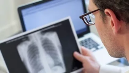 Aseguran que el consumo de drogas impulsa el aumento de casos de tuberculosis