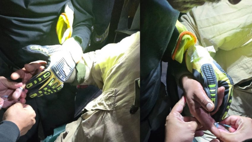 No podía sacarse un anillo y tuvo que ir a los bomberos para que lo ayudaran